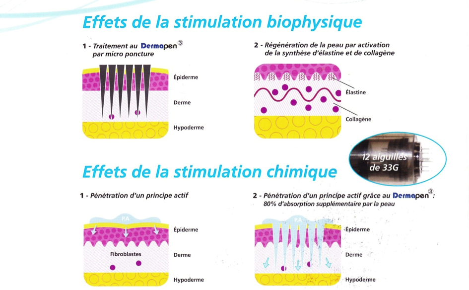 Micro needling